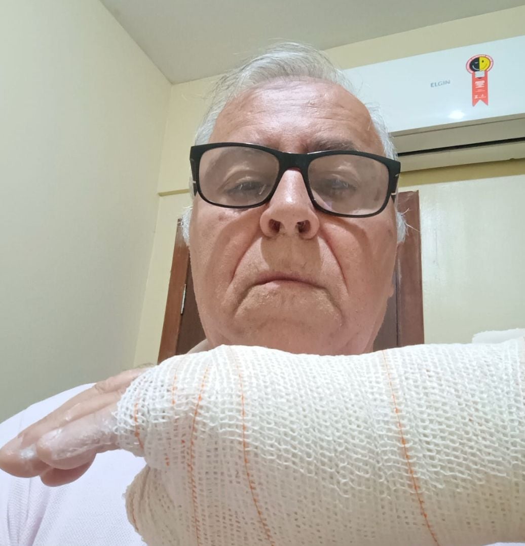 Ex-candidato a prefeito Josué Macedo sofre queda em ônibus